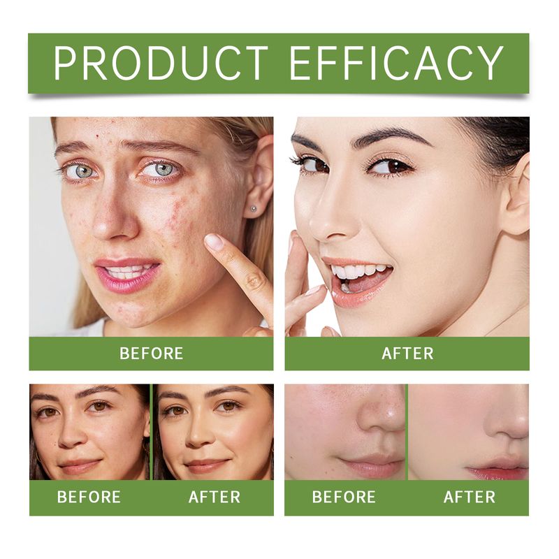 EELHOE Aloe Vera Skin Care Essence, Clear And Moisturizing Face Moisturizing And Moisturizing Skin Refreshing Essence_voghion.com