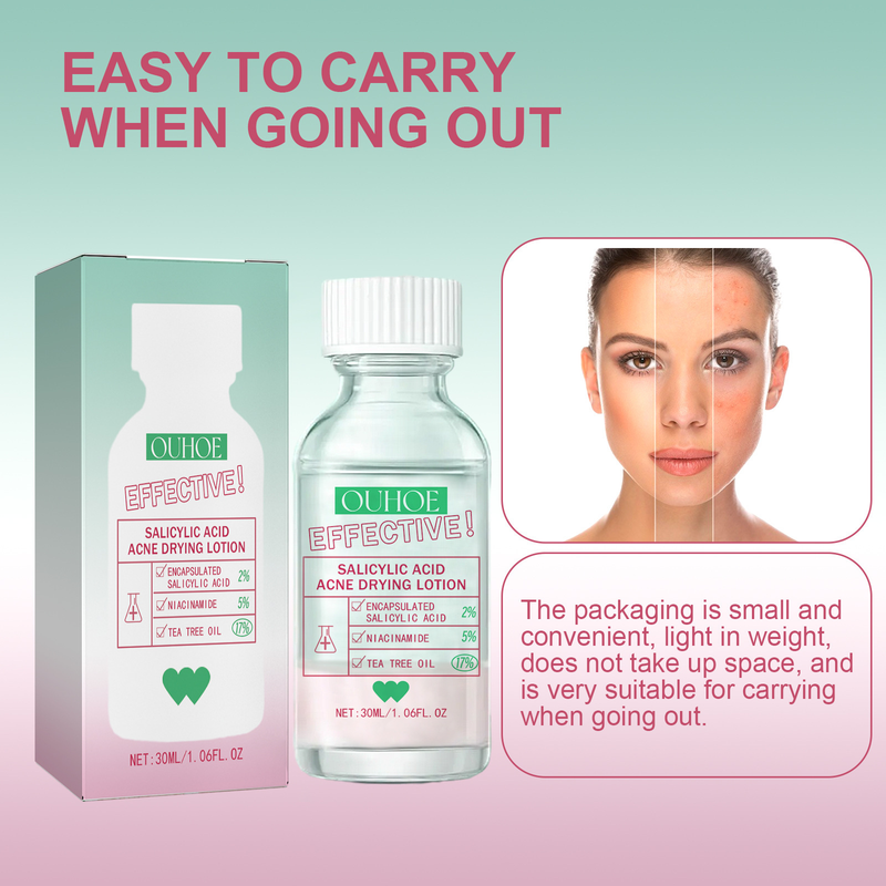 Salicylic Acid Acne Removal Serum Pimples Treatment Anti Whiteheads Oil Control Shrinking Pores Moisturizing Cleansing Skin Care Face care_voghion.com