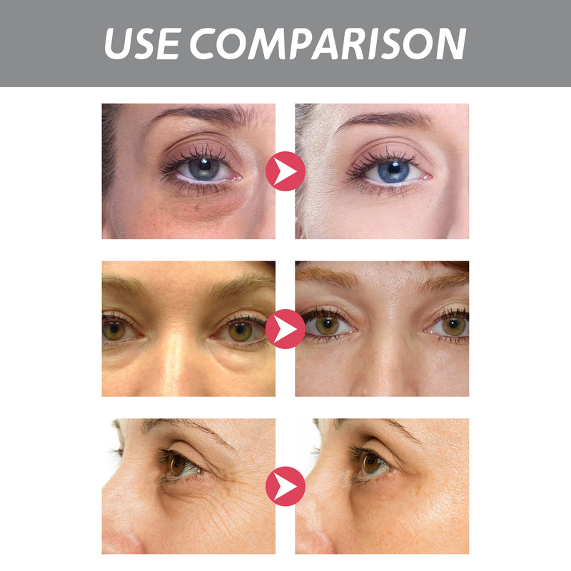 Eye Beautiful Retinol Cream Moisturizes and cares for the skin around the eyes, reducing fine lines, dark circles, and_voghion.com