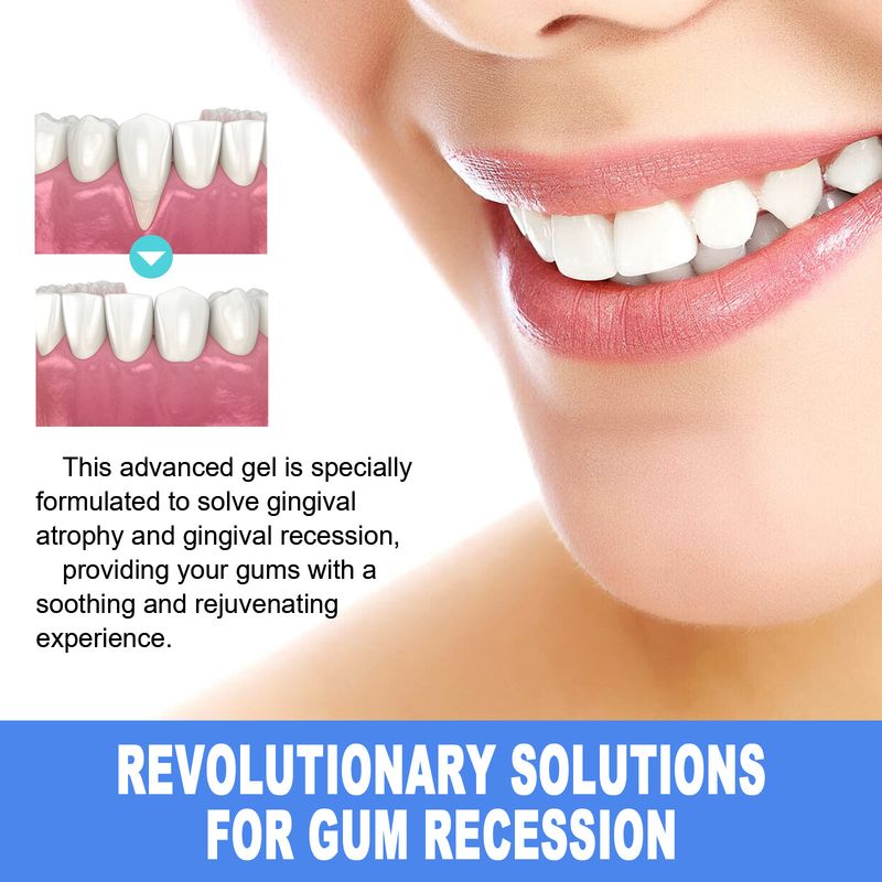 EELHOE Gentle Cleaning Yellow Teeth Tartar Stains Fresh Care Gel_voghion.com