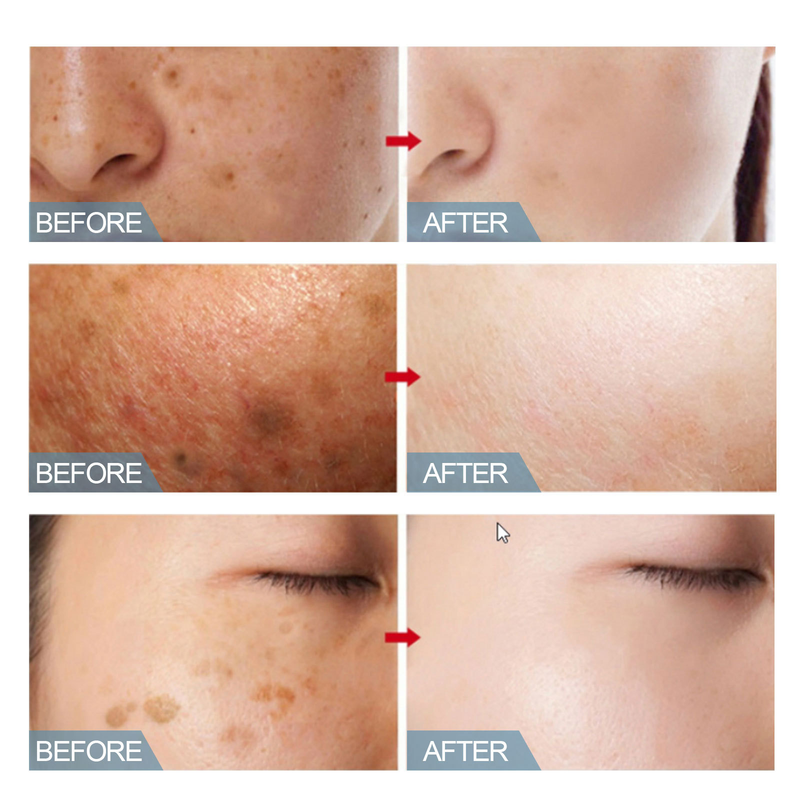 krema BeautifulK za čiščenje kože, krema za izravnavo bradavic za plosko bradavico na obrazu, glajenje nitaste oblike in Excel filim_voghion.com