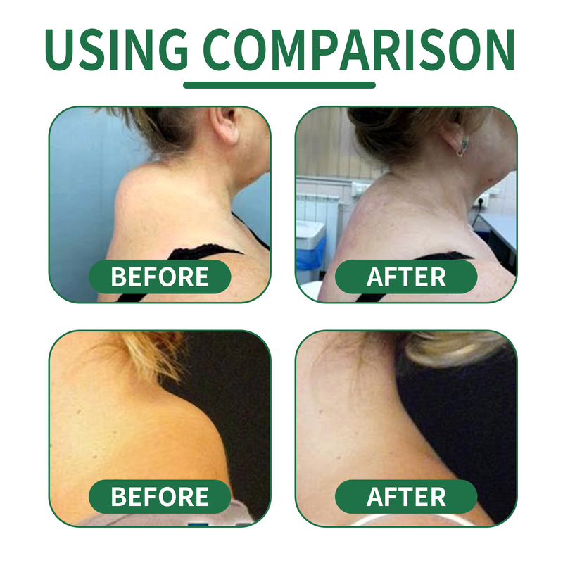 Shoulder and Beautiful Neck Hump Patch for Alleviating Muscle and Joint Pain and Discomfort in the Shoulder, Neck and _voghion.com