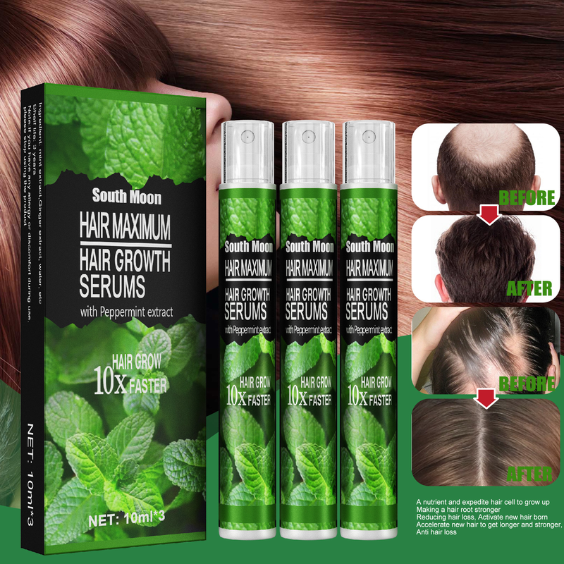 10/30 ml Haarwachstumsspray, schnell wachsendes Haaröl, Haarausfallkur für dünner werdendes Haar, Wachstumsspray, Produkte, Haarpflege für Frauen, Männer, Männer_voghion.com