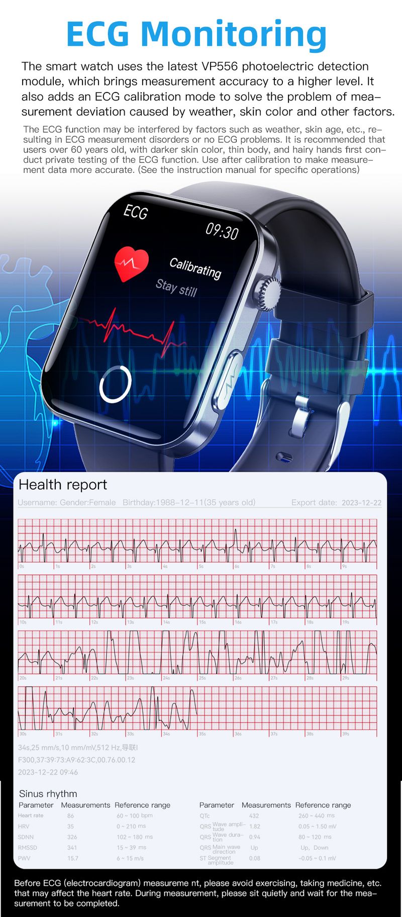 Smart Watches F300 Smart Watch SOS Heart Rate Blood Oxygen ECG Monitoring_voghion.com