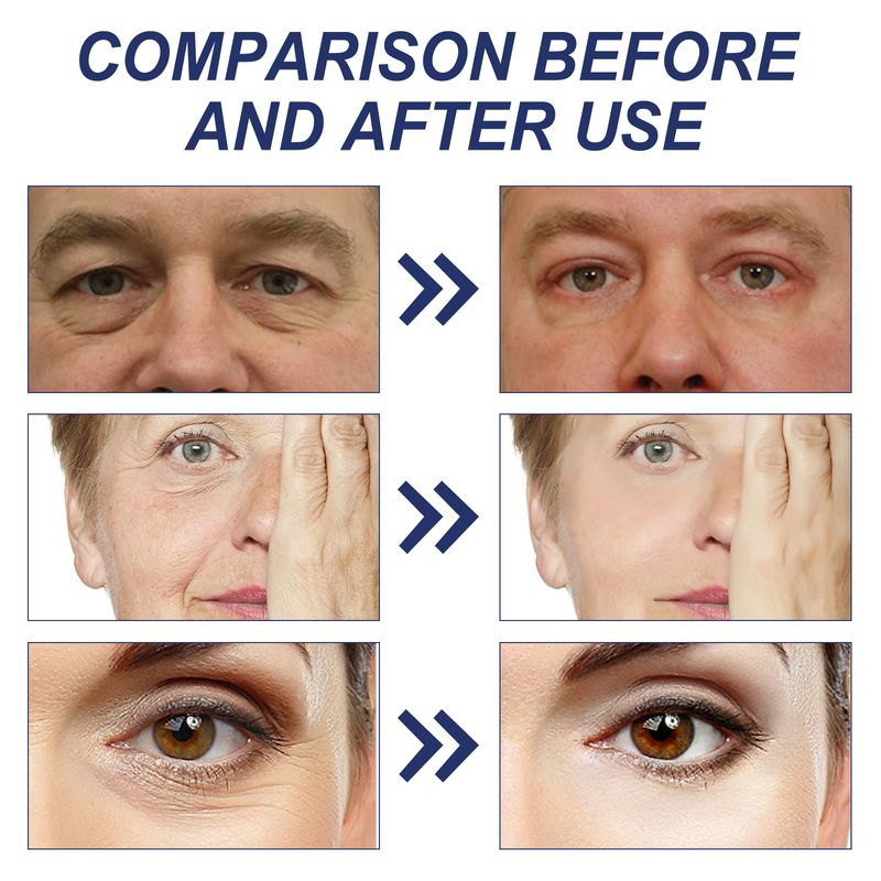 Hoygi Collagen & Retinol Cream Lighten Fine Lines, Firming Skin And Moisturizing Moisturizing Cream_voghion.com