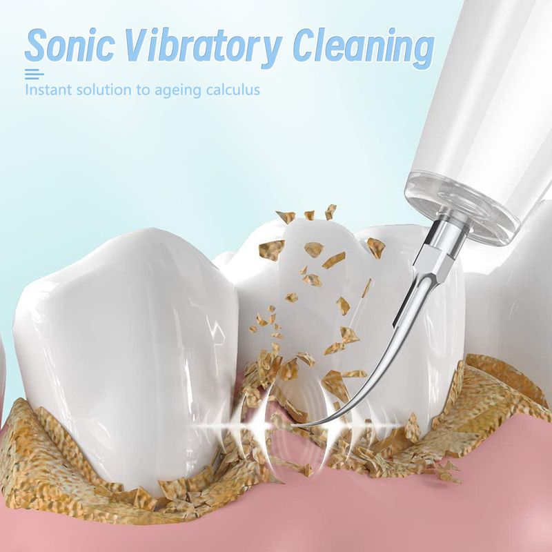 2025 Ultrasoon elektrisch apparaat voor het reinigen, bleken en spoelen van tanden, tandsteenverwijderaar, tandplakreiniger_voghion.com