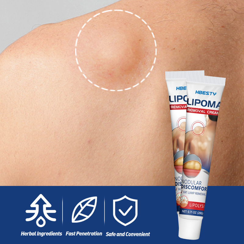 Knot Eliminating HBESTY Cream Relieving Subcutaneous Bulging of Fat Lumps and Granules_voghion.com