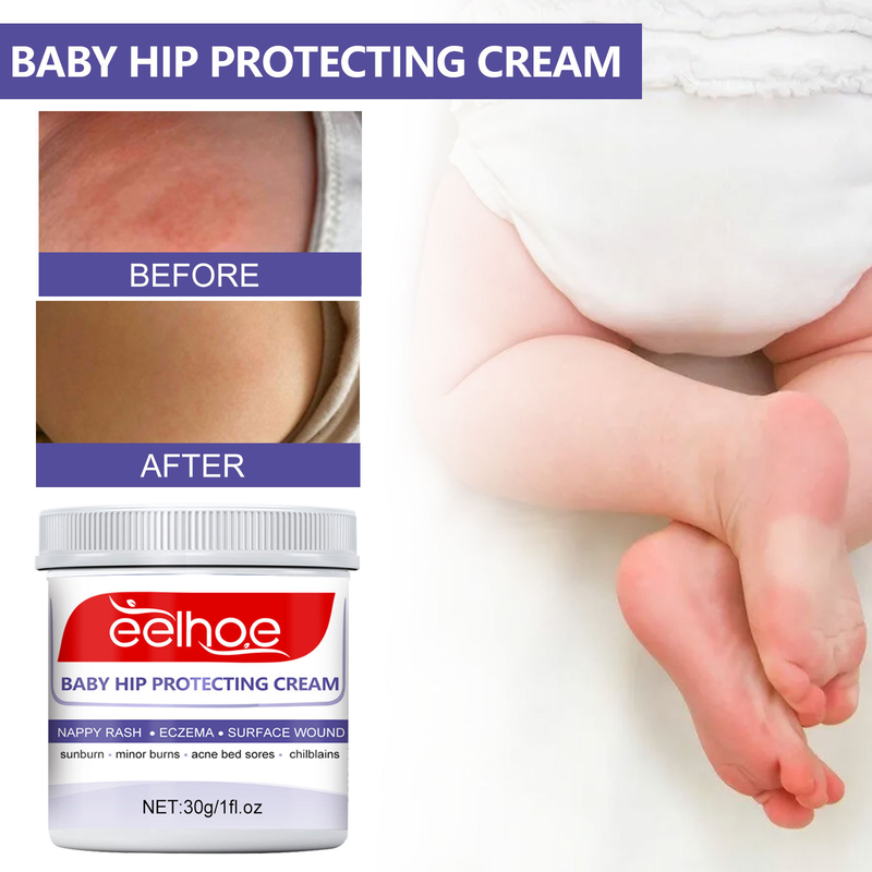 Hip Beautiful Baby Cream repariert Rötungen, Fieber und Juckreiz an der Babyhüfte und ist eine feuchtigkeitsspendende Hautpflegecreme_voghion.com