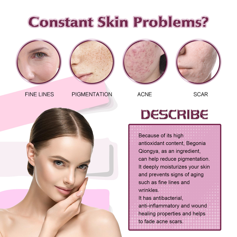 Qiongya Begonia Belle huile essentielle élimine l'acné, ferme la bouche, rétrécit les pores, répare les muscles sensibles et_voghion.com