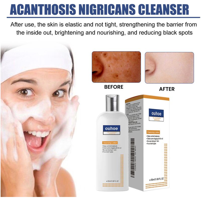 OUHOE Sort, tornet hudrens til dybderensning, blødgøring, reparation, oliekontrol og rensning af ansigtet_voghion.com