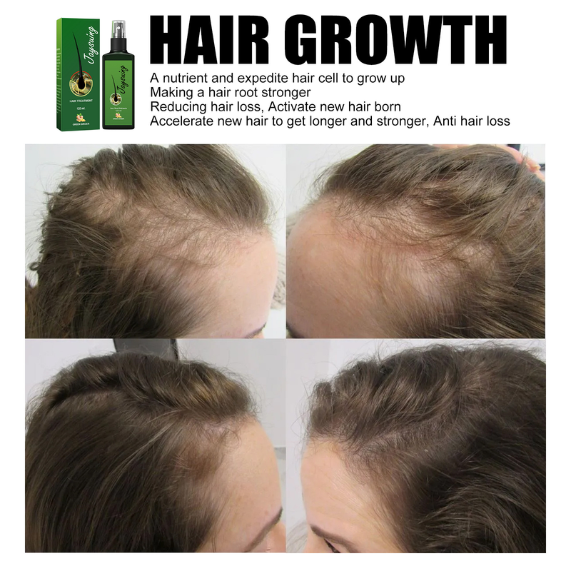 Jaysuing Lozione nutriente per massaggio del cuoio capelluto denso, nutriente, forte e resistente, per la crescita delle radici dei capelli_voghion.com