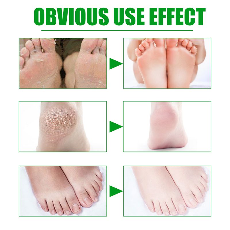 Maschera per i piedi idratante, detergente, esfoliante, ammorbidente e setosa all'aloe vera EELHOE_voghion.com