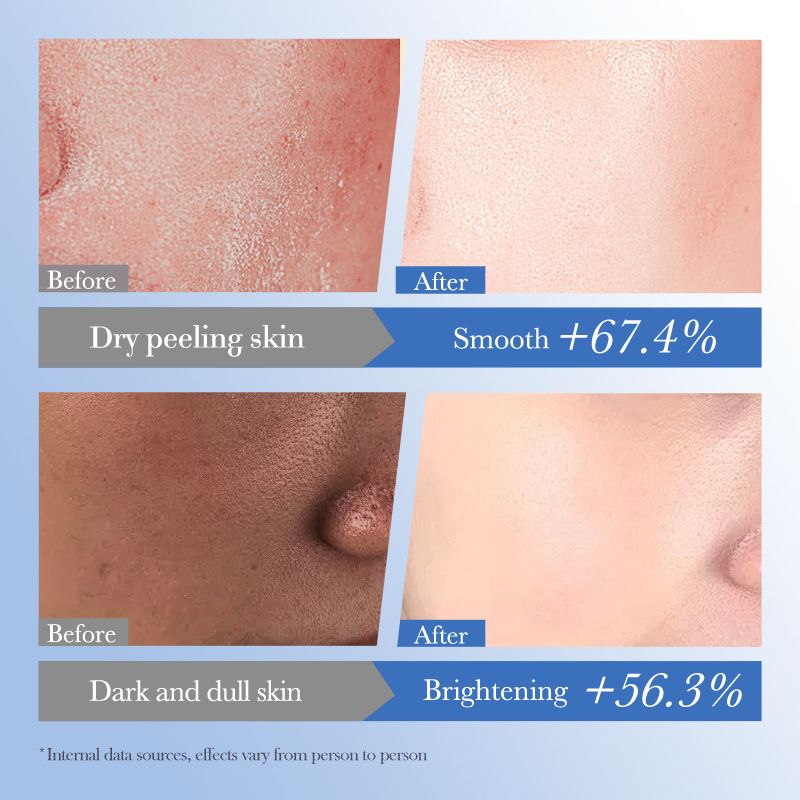 Full English BIOAOUA Ceramide Hyaluronic Acid Moisturizing Hydrating Face Cream_voghion.com