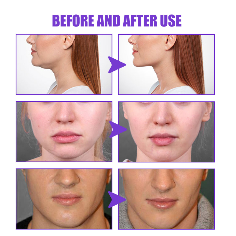 Creme Ansigtsløftning Slankende Tynd V Ansigtsløftning Opstrammende Fjernelse Masseter Muscle Dobbelthage Anti-aging Fugtgivende Skønhed_voghion.com
