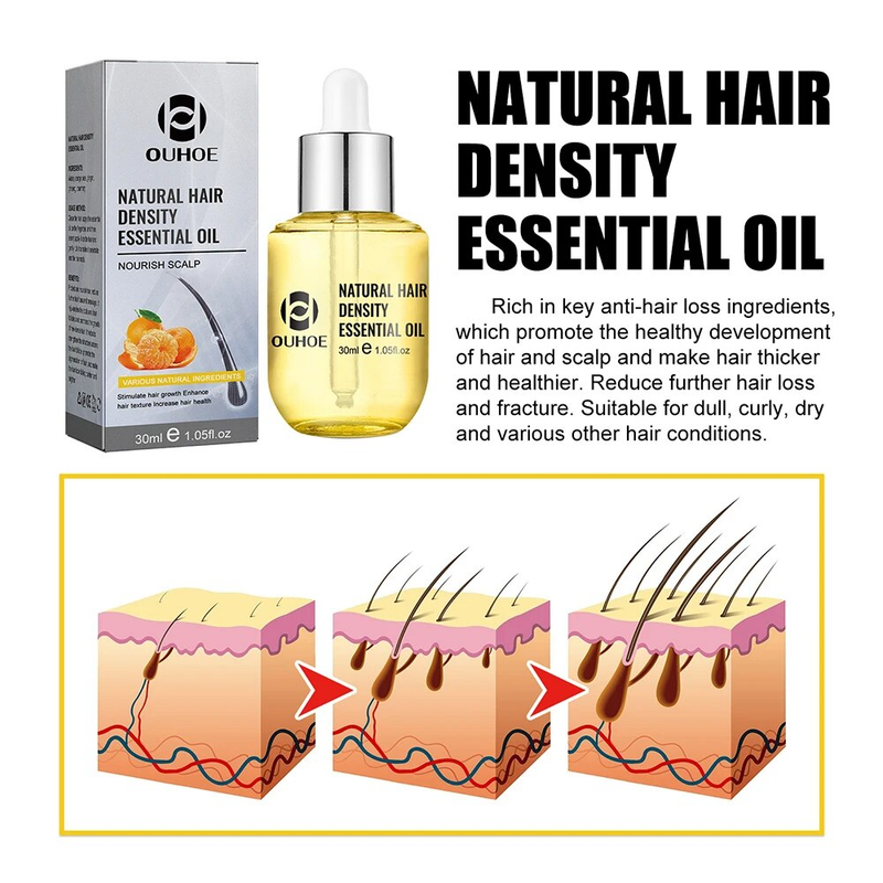Wachstum 30 ml Ingwer für Männer Frauen Anti-Haarausfall Hydratisiert dichte Reparatur Wurzeln Kopfhautbehandlung Massage Essentials_voghion.com
