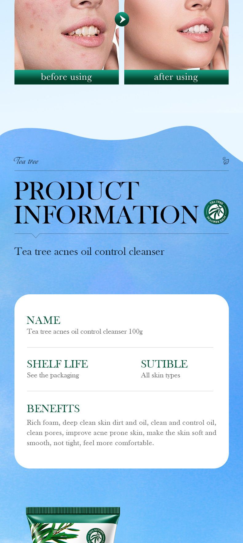 Kit per la cura della pelle SADOER Tea Tree Acne and Oil Control da sei pezzi, detergente detergente delicato per la rimozione dell'acne e detergente viso per studenti_voghion.com