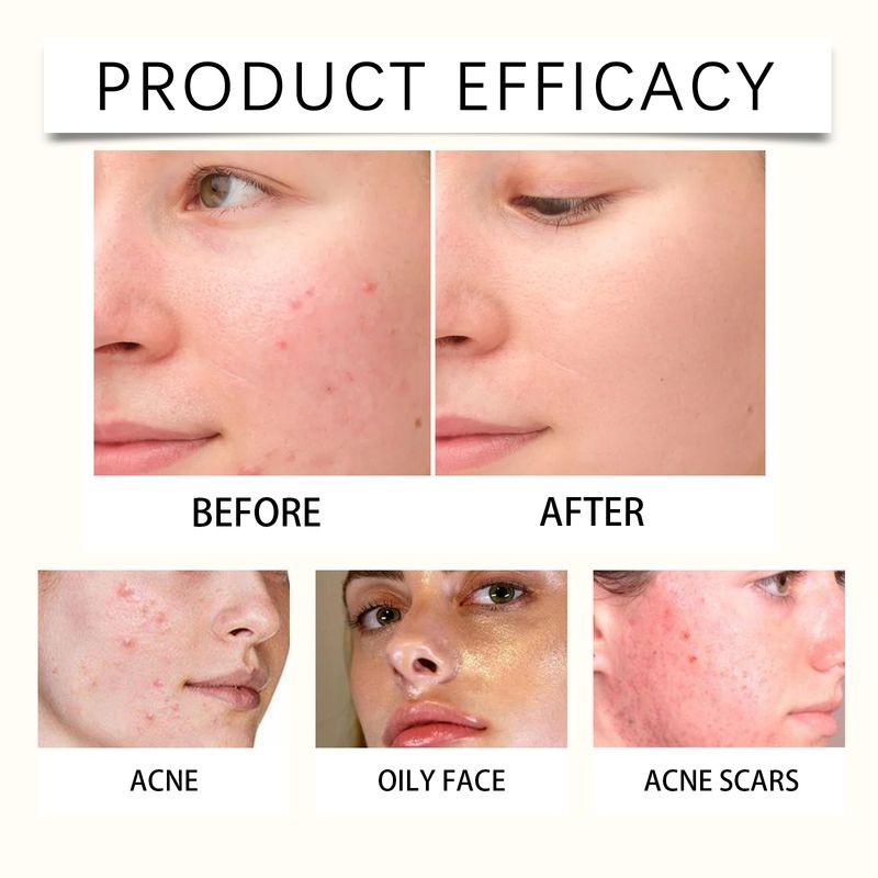 Hoygi Rice Moisturizing Face Cream Moisturizes Skin With Refreshing, Gentle And Moisturizing Radiance_voghion.com