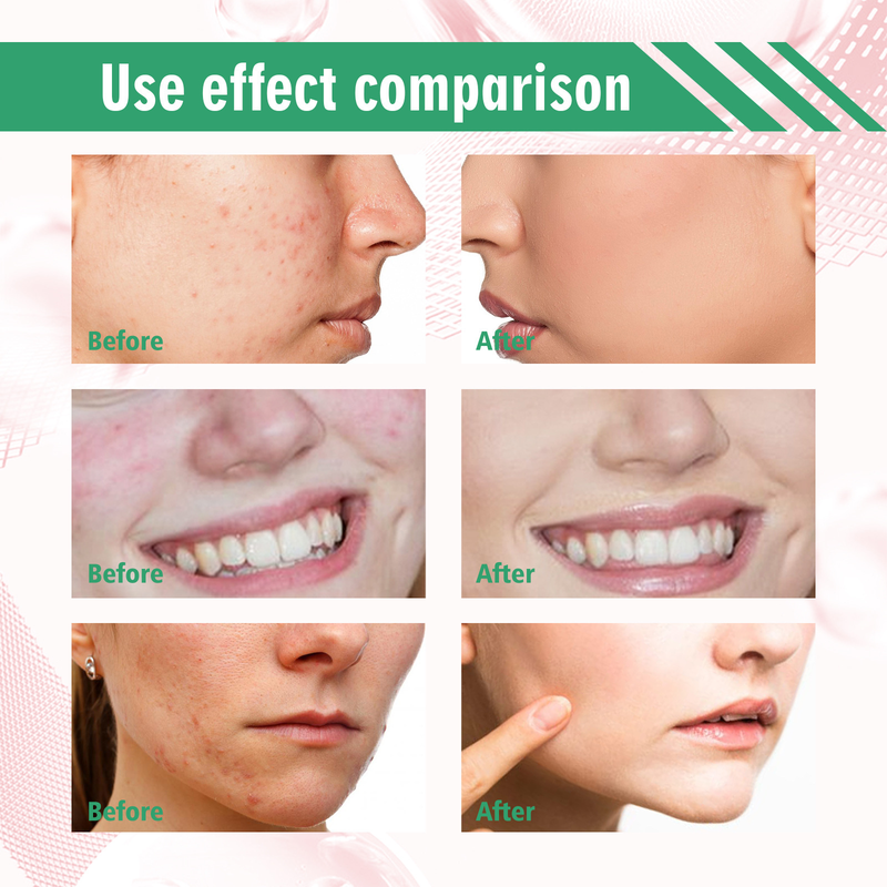 Maschera viso all'argilla Hoygi Pulisce in profondità i pori, schiarisce l'acne, rassoda, ammorbidisce e leviga la pelle Maschera di fango in stick_voghion.com