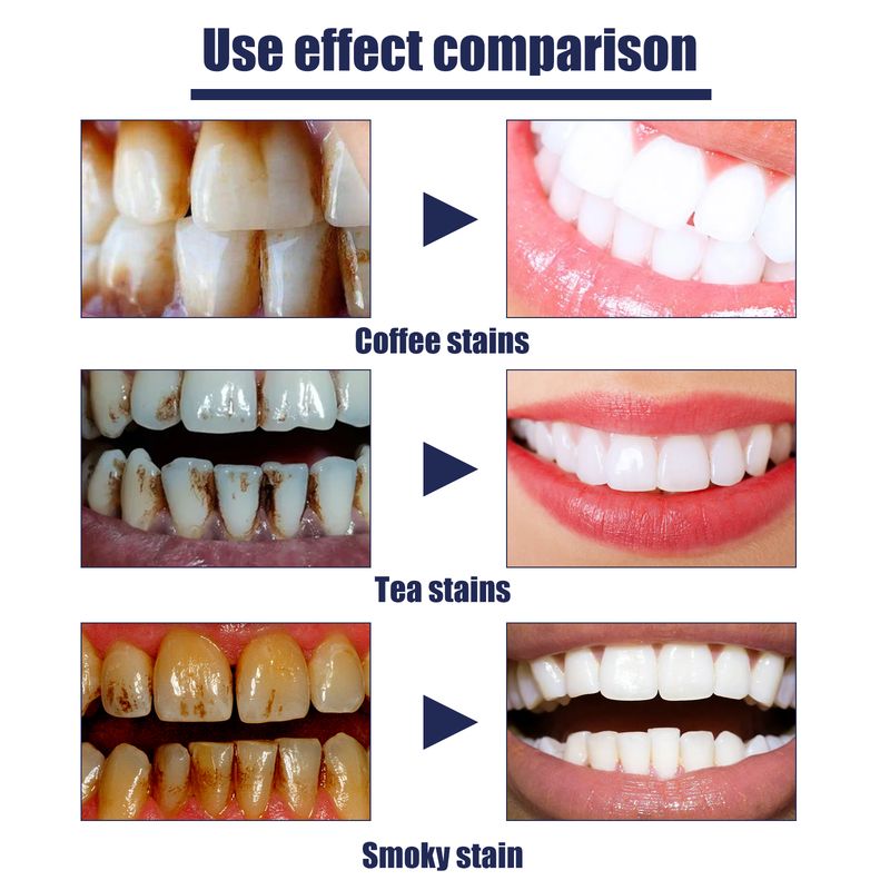 EELHOE Toothpaste, Clean Fresh Breath Remove Stains Whitening Teeth Toothpaste_voghion.com