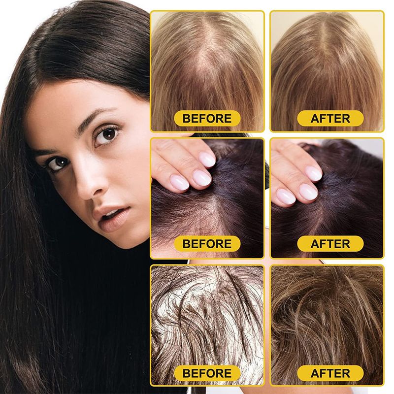 IBeaLee Rice Aquatic Ginger King Root Capelli liquido nutriente Essenza anti-spargimento_voghion.com