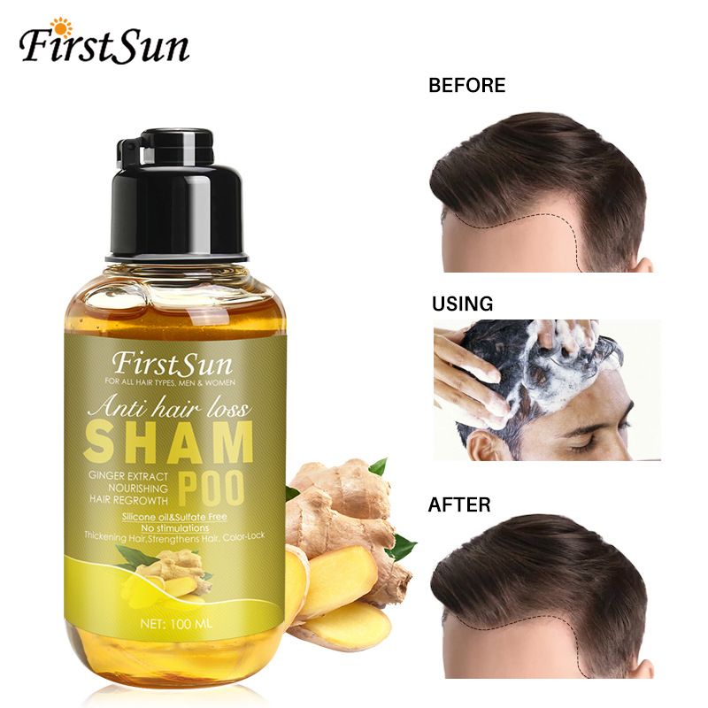 Kexun Firstsun Ingwer Erfrischendes, geschmeidiges, pflegendes Shampoo gegen Haarausfall_voghion.com