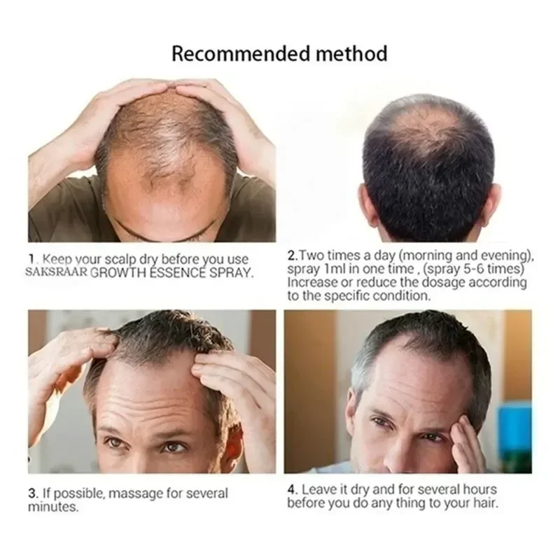 Rychlé 24ss sérum na růst vousů Olej na vousy Tekutina pro regeneraci axilárních a hrudních vlasů Delší Hustší Prevence Alopecia Anti-H_voghion.com
