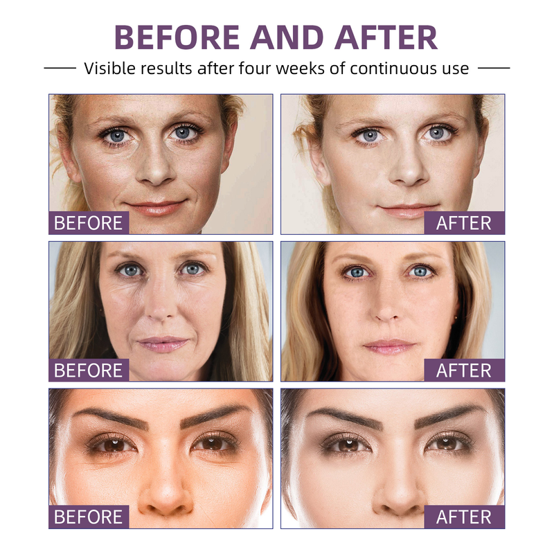 Jayswing Anti-rynkefuktighet kan redusere fine linjer, lysne huden, fukte og stramme opp essensen_voghion.com