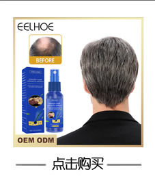 Ingefær Hår Vakker Vekstspray Tøft hår Massasje Hodebunn Tett hår Oppstrammende hårtap Forebygging Reparasjon Nærende_voghion.com