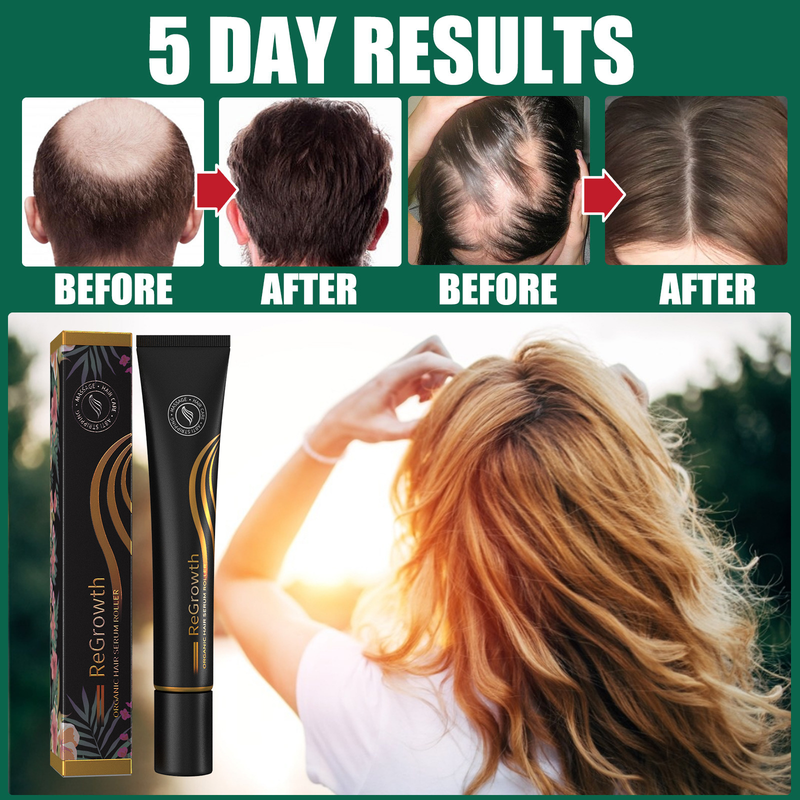Capelli 1PCS Set di rulli per siero per la ricrescita Siero per la crescita dei capelli Triple Roll-On Massaggiatore Essenza per la crescita dei capelli per le donne degli uomini_voghion.com