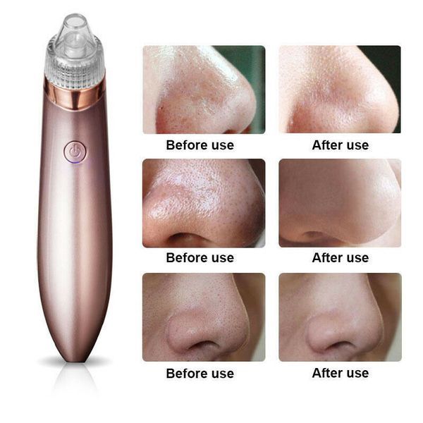 Aspirateur électrique pour points noirs, nettoyeur de pores, élimine les boutons d'acné, outil d'aspiration puissant, élimine les points noirs, aspiration sous vide des pores, dermabrasion au diamant F_voghion.com