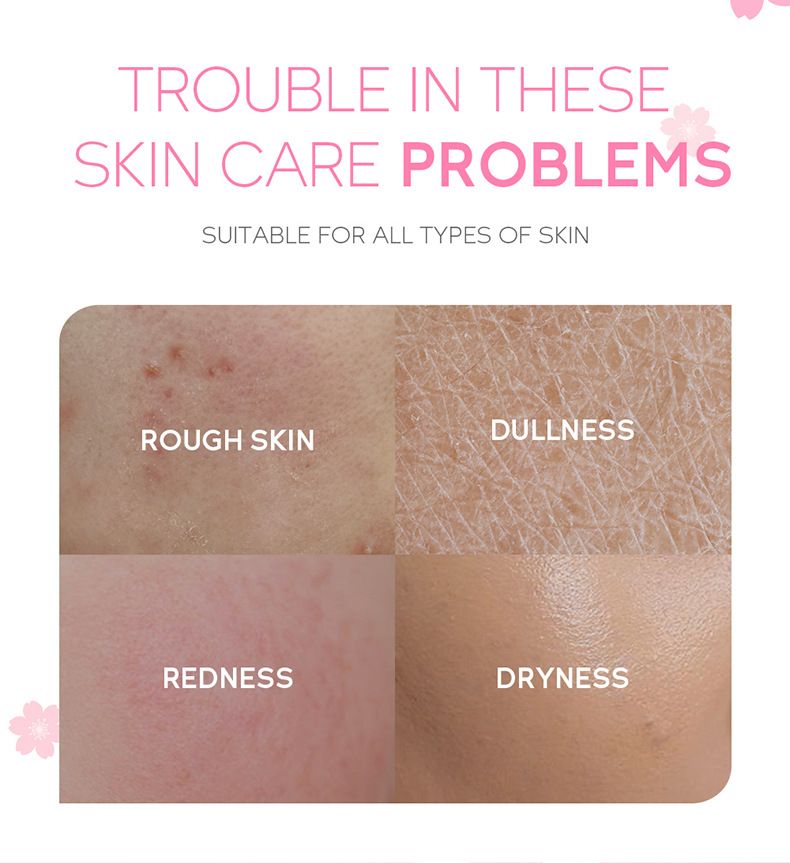 FENYI Sakura 4 daļu ādas kopšanas produktu komplekts mitrinošs un saudzīgs 1 daļas 2 g izmēģinājuma iepakojums ādas kopšanai_voghion.com