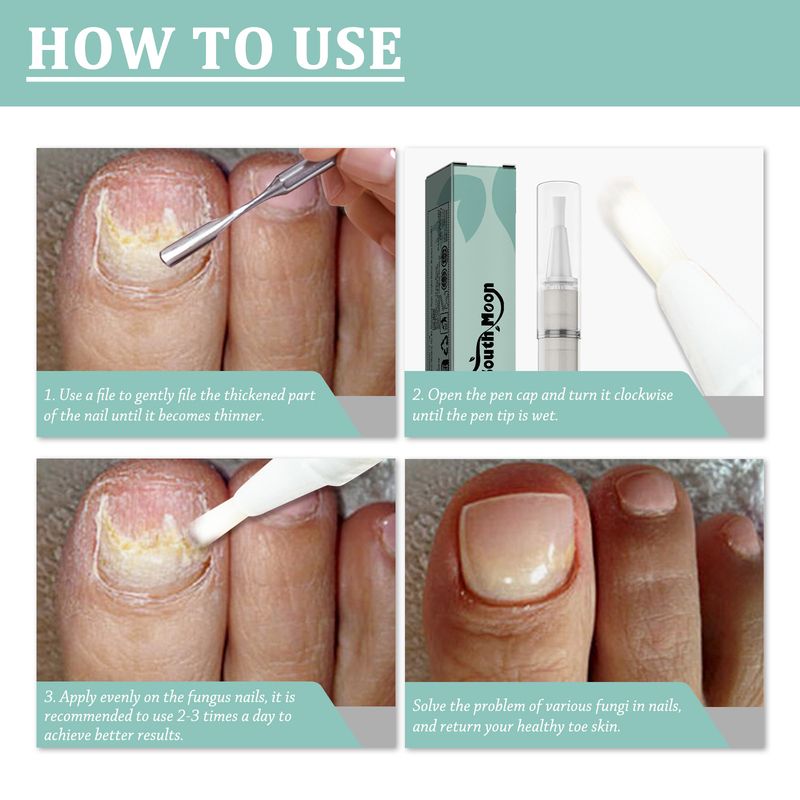 Penna per la cura delle unghie, detergente, illuminante e ispessente, per la cura delle onicomicosi_voghion.com