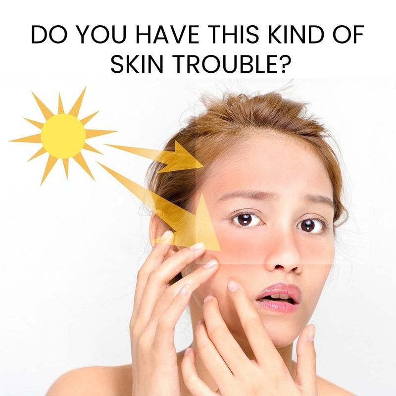 EELHOE Protective Moisturizing Cream Resists Scorching Sun Exposure Protects The Body's Skin From Moisture, Refreshing,_voghion.com