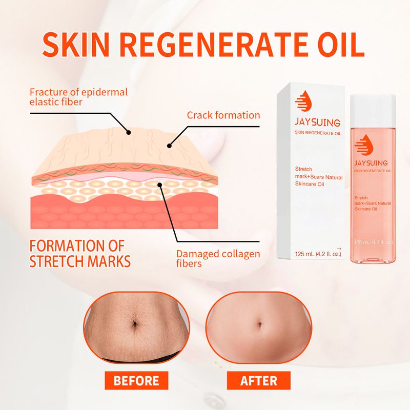 Repair Ja, Tighten Abdomen, Massage Shape The Body, Smooth Moisturize Scars, Fade Stretch Marks, And Use Oil_voghion.com