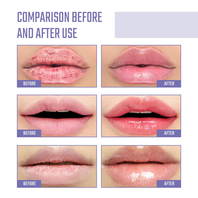 OUHOE Collagen Repair Lines, Remove Dead Skin, Prevent Dry Cracks, Moisturize and Care Lip Mask_voghion.com