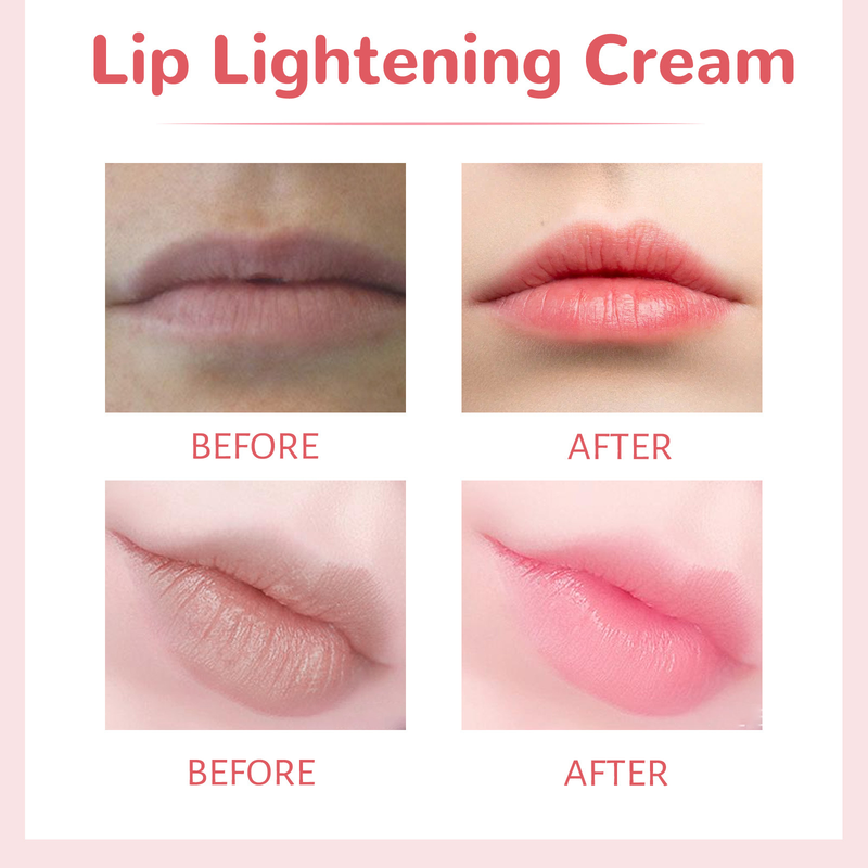 Lippenaufhellungscreme, feuchtigkeitsspendender Balsam, Aufhellung, Aufhellung, nährender Lippenstift, dunkle Lippenpflege, Bleichcreme, 30 g, weiblich_voghion.com