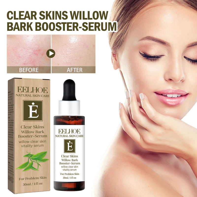 EELHOE Cleansing Willow Bark-essentie kan de droogheid verlichten, acnevlekken vervagen, de huid reinigen, hydrateren en een gevoelige huid veroorzaken_voghion.com