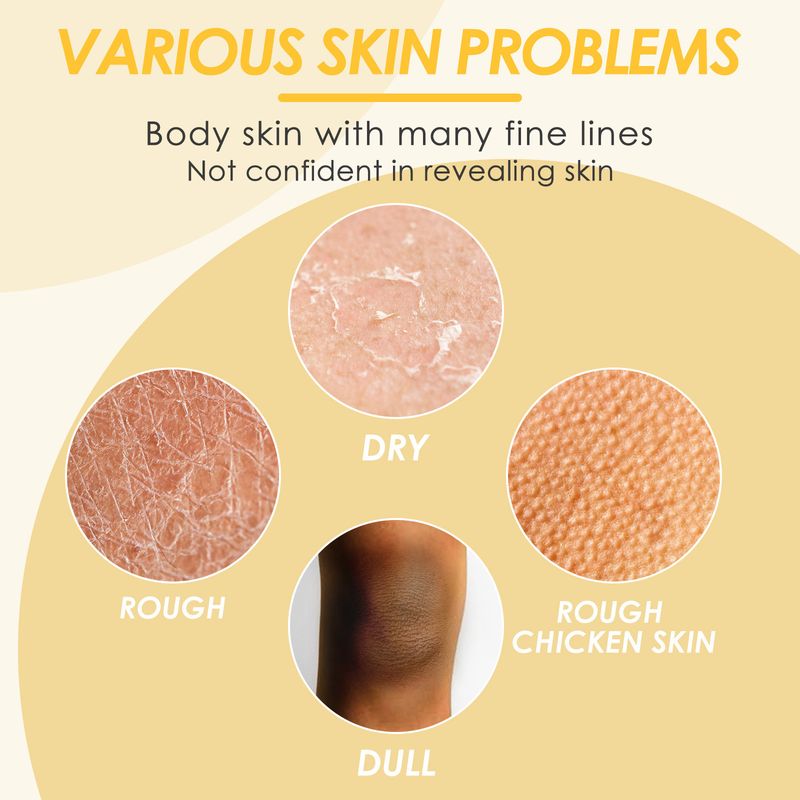 OUHOE Mango Body Moisturizing Cream Hydrateert de huid, vult vocht aan, hydrateert en voorkomt schilfering_voghion.com