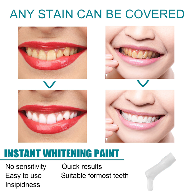 Tooth Whitening Stains Stains, Preventing Pigment Deposition, Cleaning Oral Odors, and Caring for Teeth Paint_voghion.com