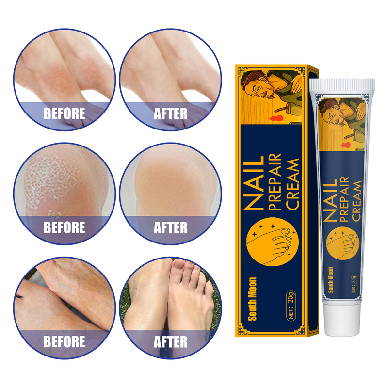 South Moon Fußpflegecreme pflegt, schützt die Füße, beseitigt Geruch, Juckreiz, spendet Feuchtigkeit, beugt Fußreizungen vor_voghion.com