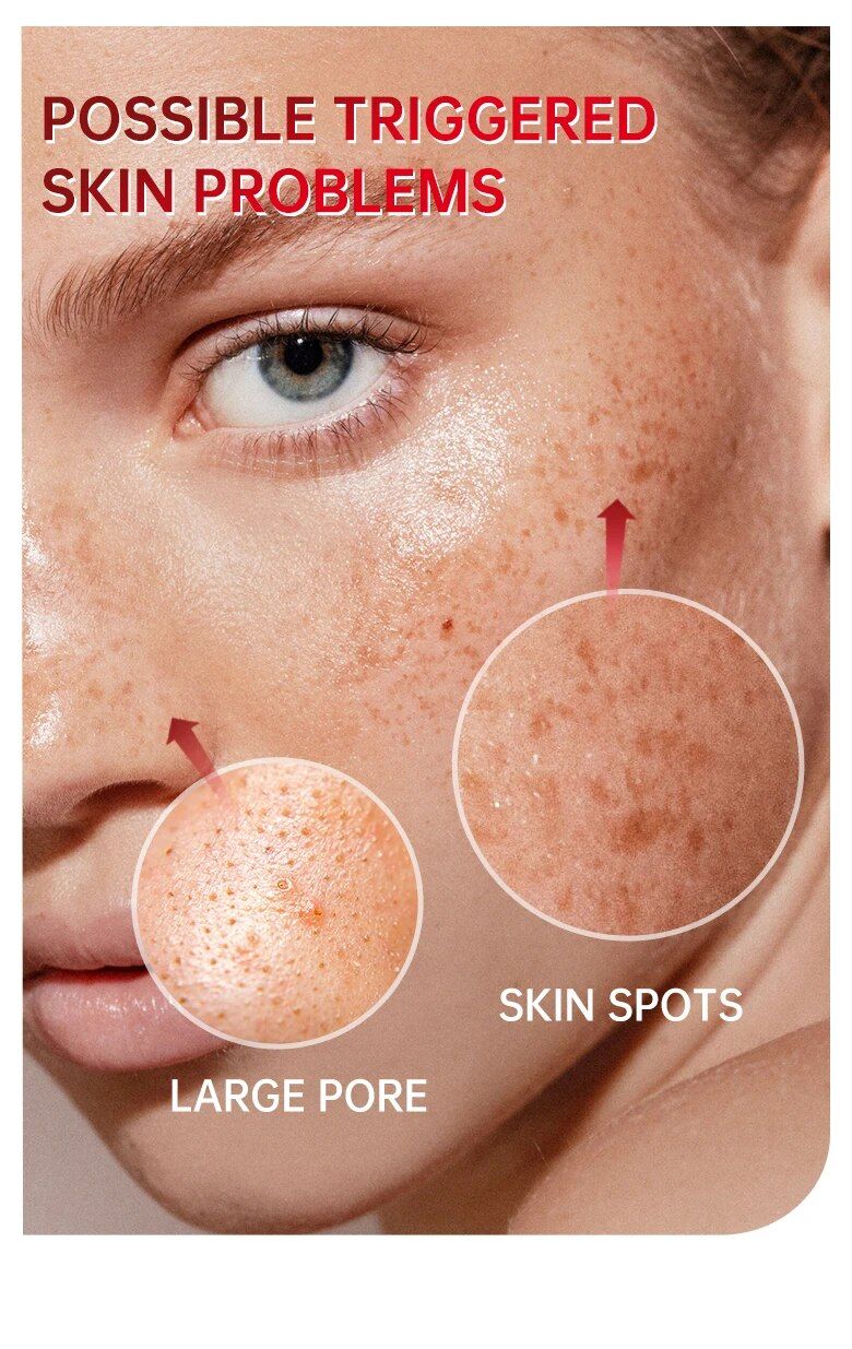 Negozio di prodotti per la cura della bellezza Restringimento dei pori Niacinamide Siero per il viso Sbiadimento Macchie scure Acido ialuronico Sbiancamento Idratante Collagene Anti-età_voghion.com