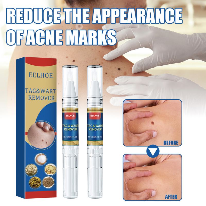 EELHOE Skin Care Pen (1pc) Is A Gentle Ingredient With Body Skin Care Liquid That Cleanses The Skin_voghion.com