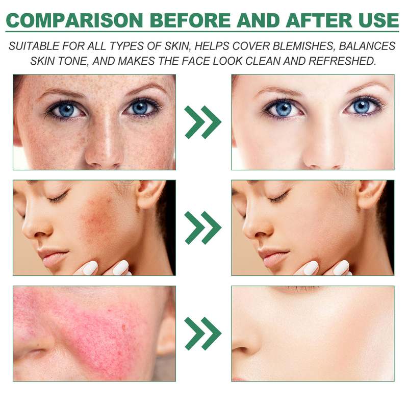 Soin correcteur de couleur West&Month pour éclaircir les taches, réparer le teint terne après une exposition au soleil et hydrater la crème pour la peau_voghion.com