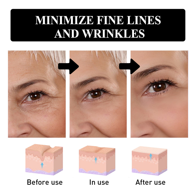 Lifting Relieving Dry Lines in the Eye, Moisturizing and Improving Fine Line Firming Eye Cream_voghion.com