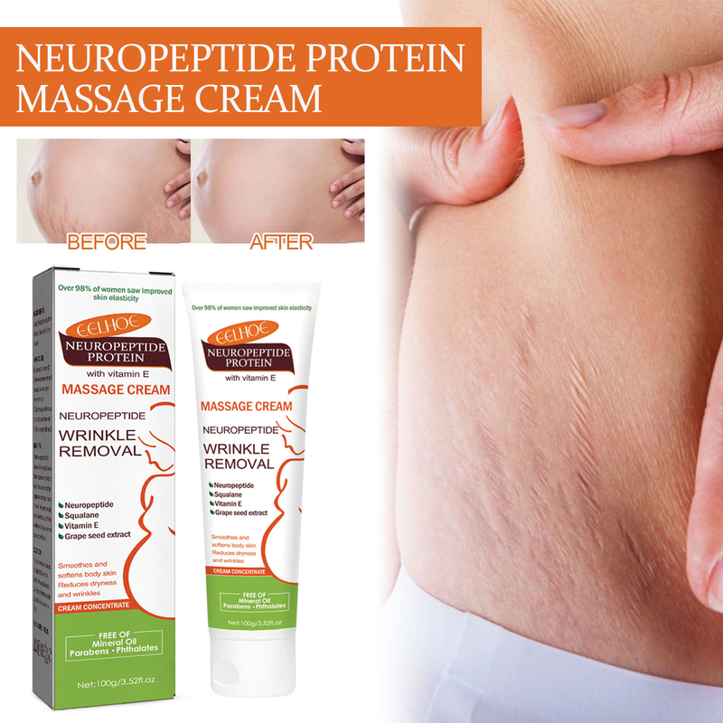 EELHOE Neuropeptid-Protein-Narbenlinderung, Schwangerschaft, Körperlinienpflege, Massagecreme für glatte Haut_voghion.com