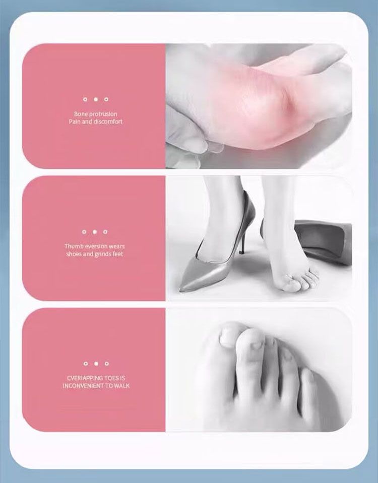 Separatore dita in silicone da 2 pezzi, dita dei piedi, divaricatore dita, alluce valgo, correttore di dita dei piedi, separatore di dita_voghion.com