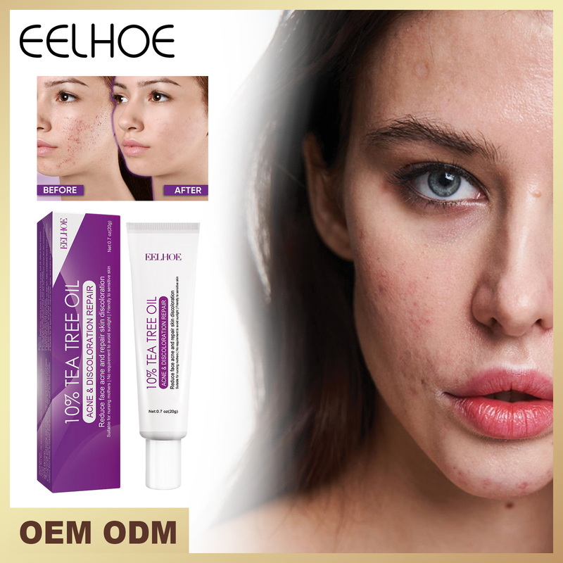 Skaists un balinošs krēms plankumus mazina, atjauno tumšos plankumus, mitrina, nostiprina un piešķir mirdzumu._voghion.com