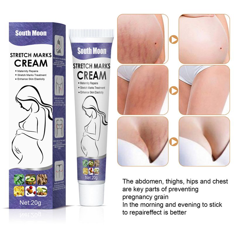 South Moon Desalinates Skin Patterns and Smoothes Postpartum Pregnancy Scar Repair Cream_voghion.com