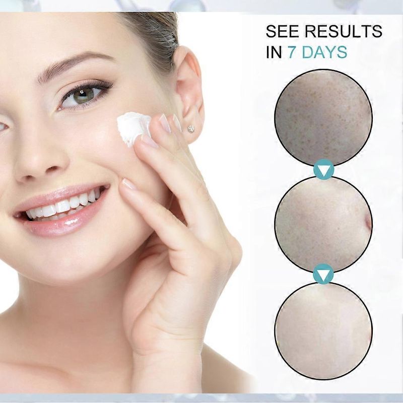 2 stuks 2023 NIEUWE Donkere Vlekken Corrector Remover Gezichtsblekende Anti-rimpel Verhelderende Crème_voghion.com