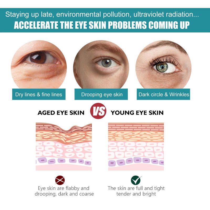 Retinol Anti-wrinkle Eye Cream Dark Circles Eye Bags Remove Anti-puffiness Fade Fine Lines Moisturizing Eye Care Original 2024_voghion.com